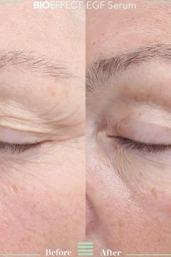 Sale EGF Serum seerumi 15ml Ihonhoidon Tehoaineet|Kasvojenhoito