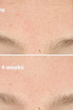 Clinique Hajusteettomat Ihonhoidon Tuotteet|Kasvojenhoito<Clarifying Do-Over Peel kuorintavoide 30 ml